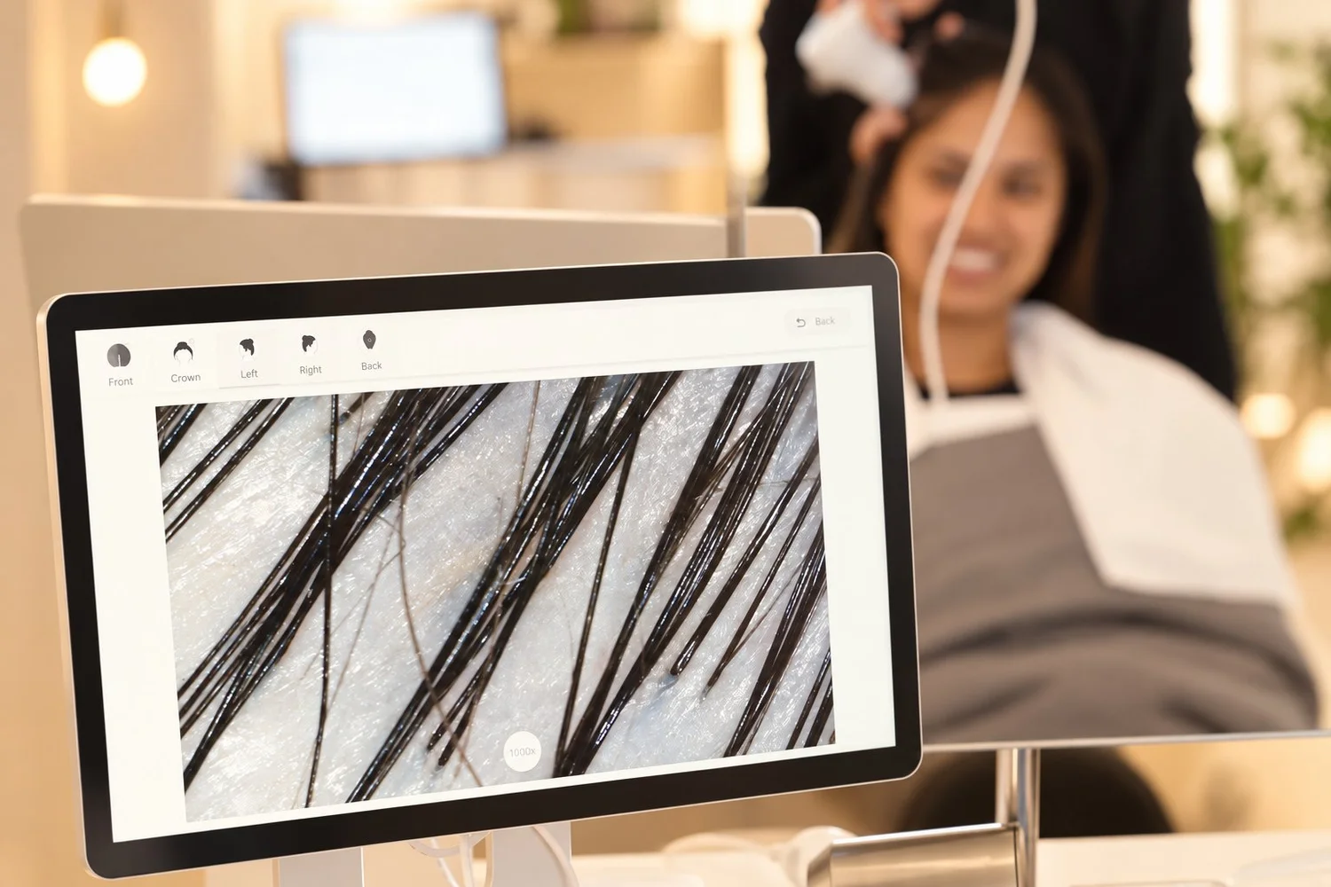 Magnified scalp analysis on screen during a consultation at Cosh Head Spa