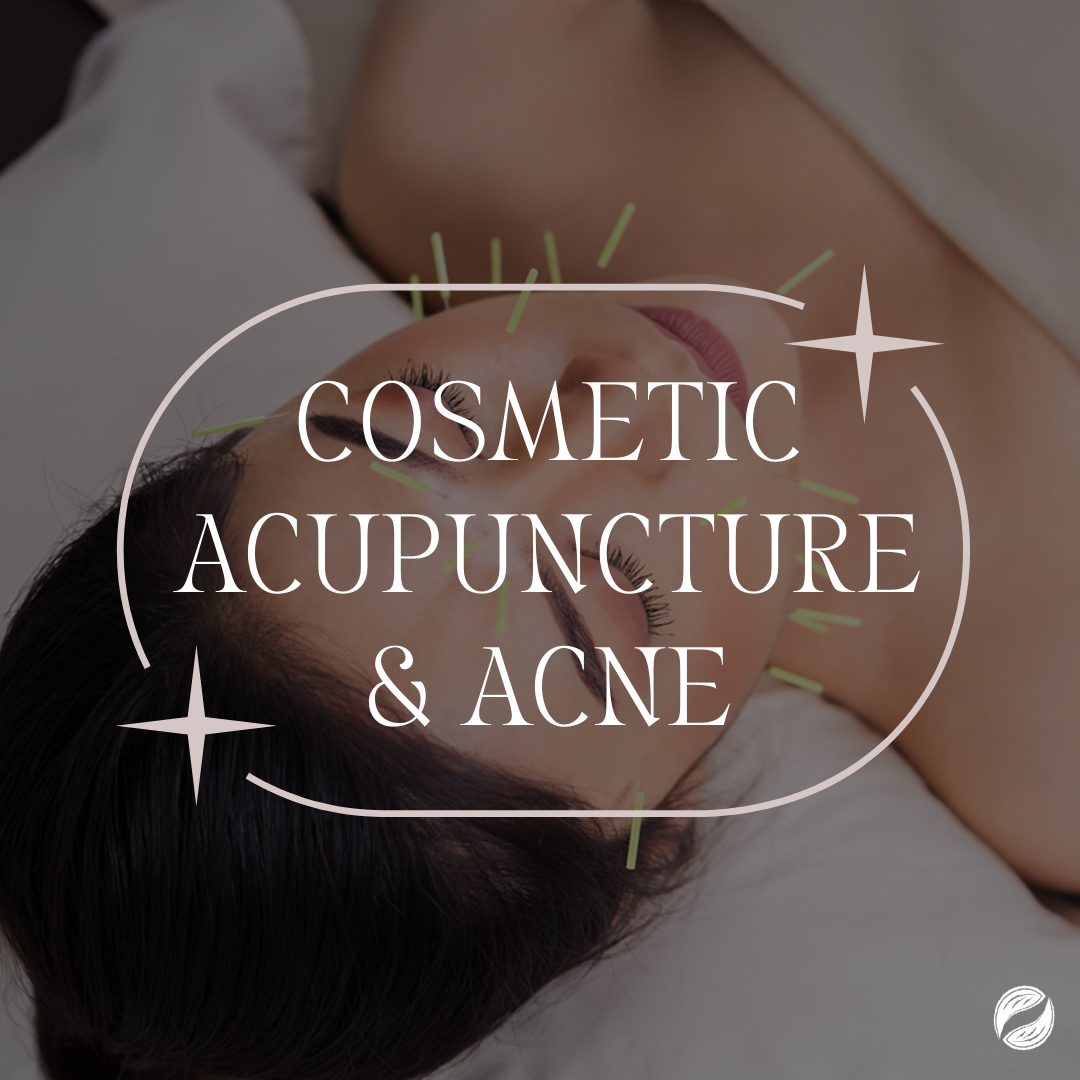 Cosmetic Acupuncture? For My Acne? Okay, Let’s Talk.