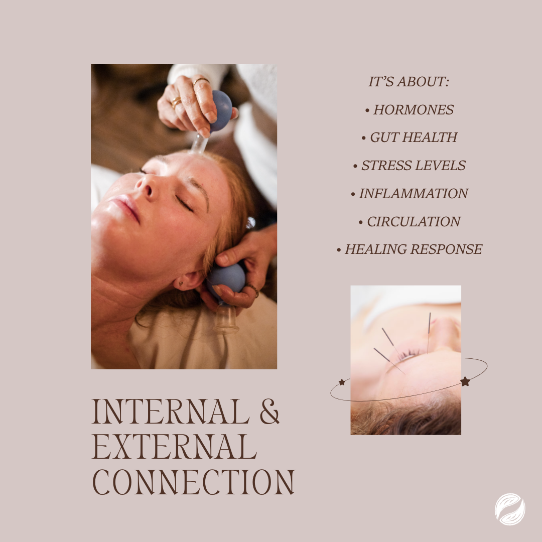 Close-up of a person's forehead receiving very fine cosmetic acupuncture needles for acne treatment and cupping, showing the calming, anti-inflammatory effect. Text summarizes the internal and external connection from the text on the left.