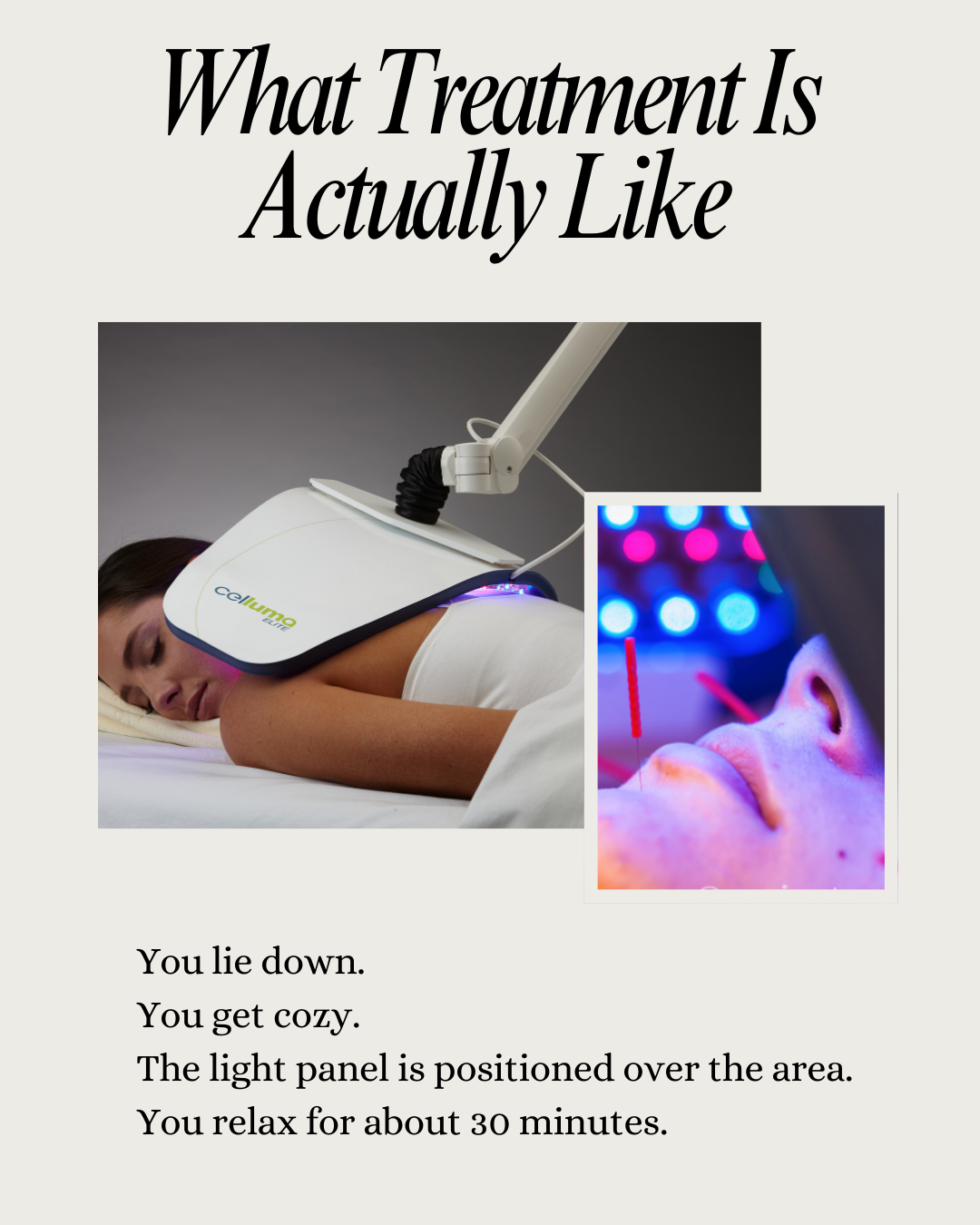 Image of a woman using Celluma LED Pro for acne on her back. The other image shows a close up of cosmetic acupuncture and Celluma LED Pro over the face. Text describes the treatment being realizing, non invasive and lasting 30 minutes.