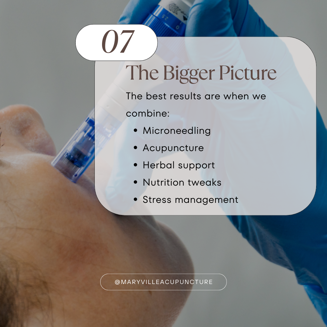 Upclose image of micro needling pen on a woman's face for acne scarring. The text summarizes this blog section about the achieving the best results.