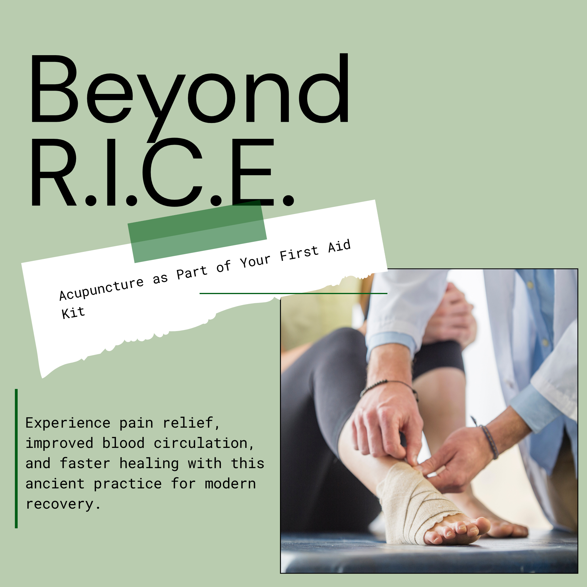 A photo of an acute injury being iced and text describing acupuncture as a powerful tool for acute injury.