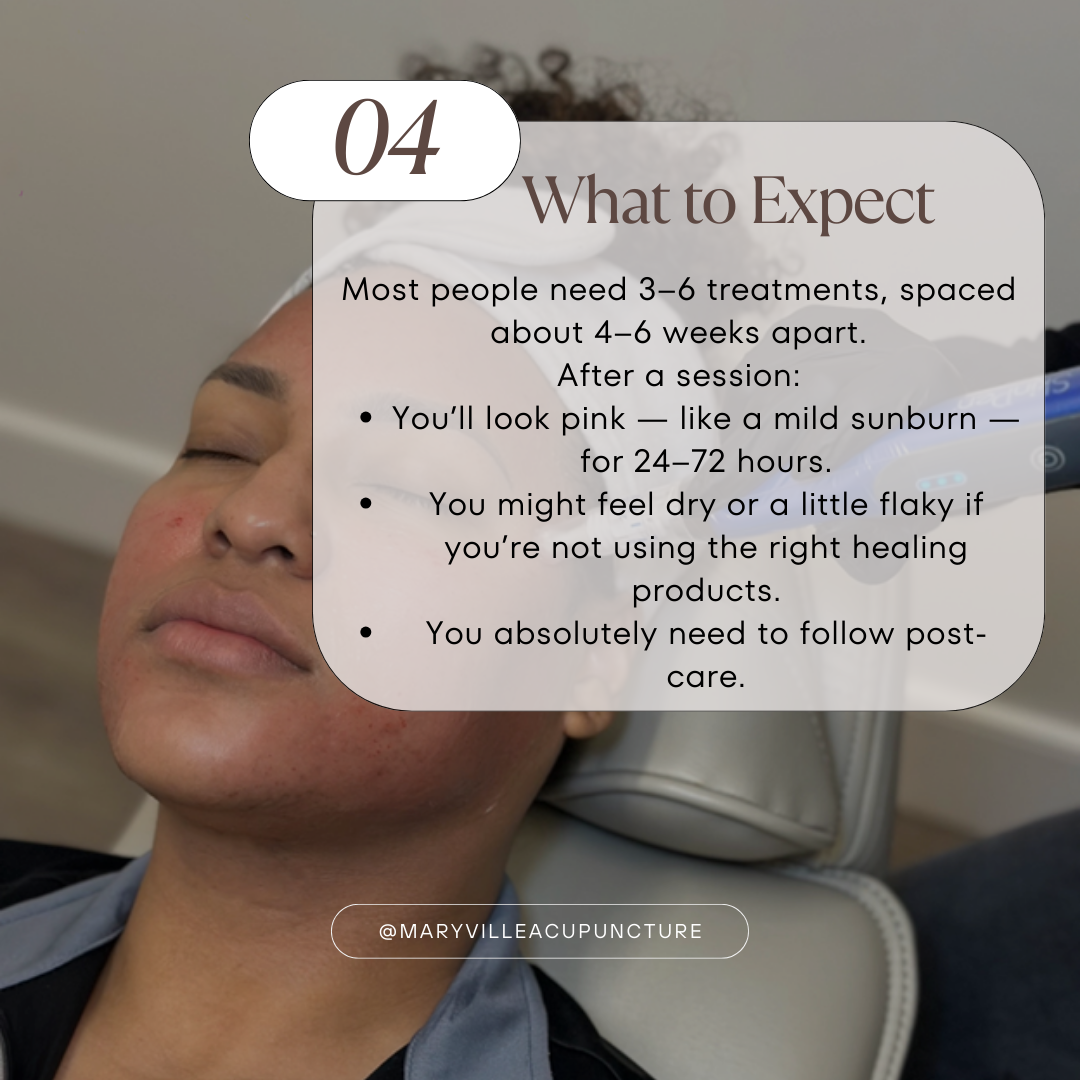 Close up of a woman's face with some acne lesions with text summarizing this section of the blog about what to expect from treatment and treatment recommendations.