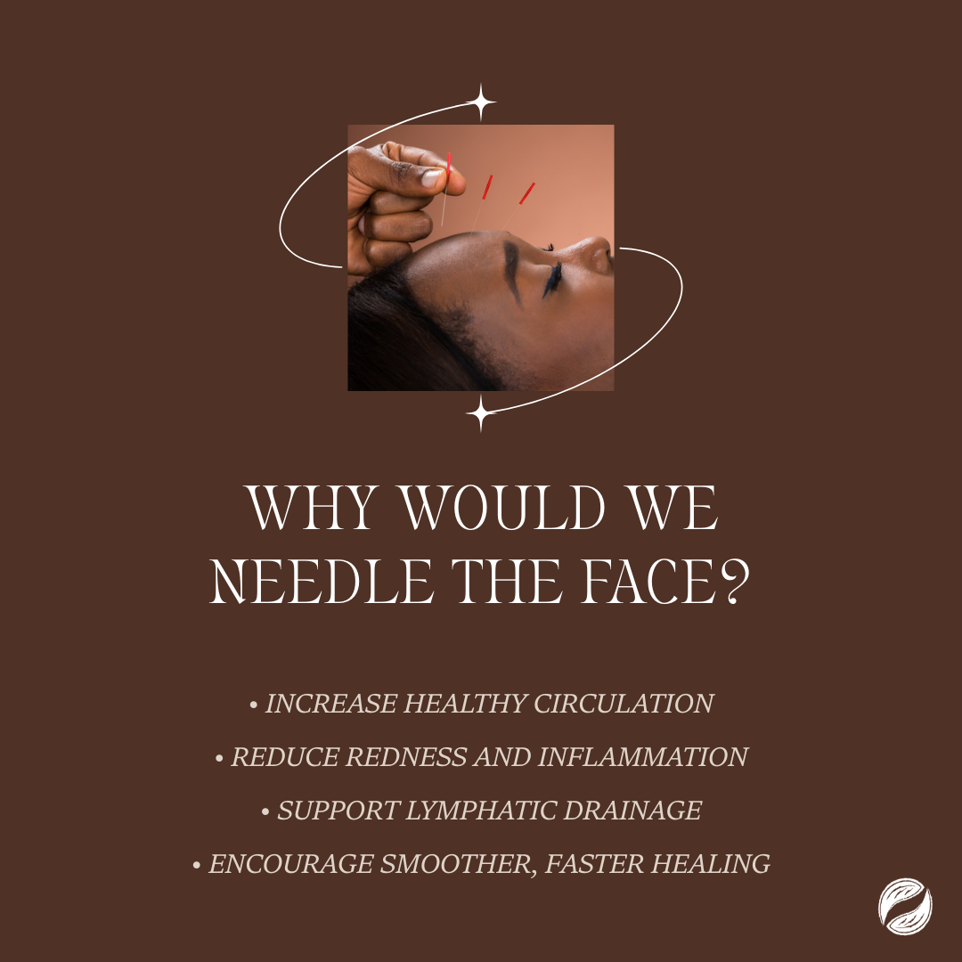 Close-up of a person's face receiving very fine cosmetic acupuncture needles for acne treatment, showing the calming, anti-inflammatory effect. The text: Why would we needle the face? Increase healthy circulation. Reduce redness and inflammation."