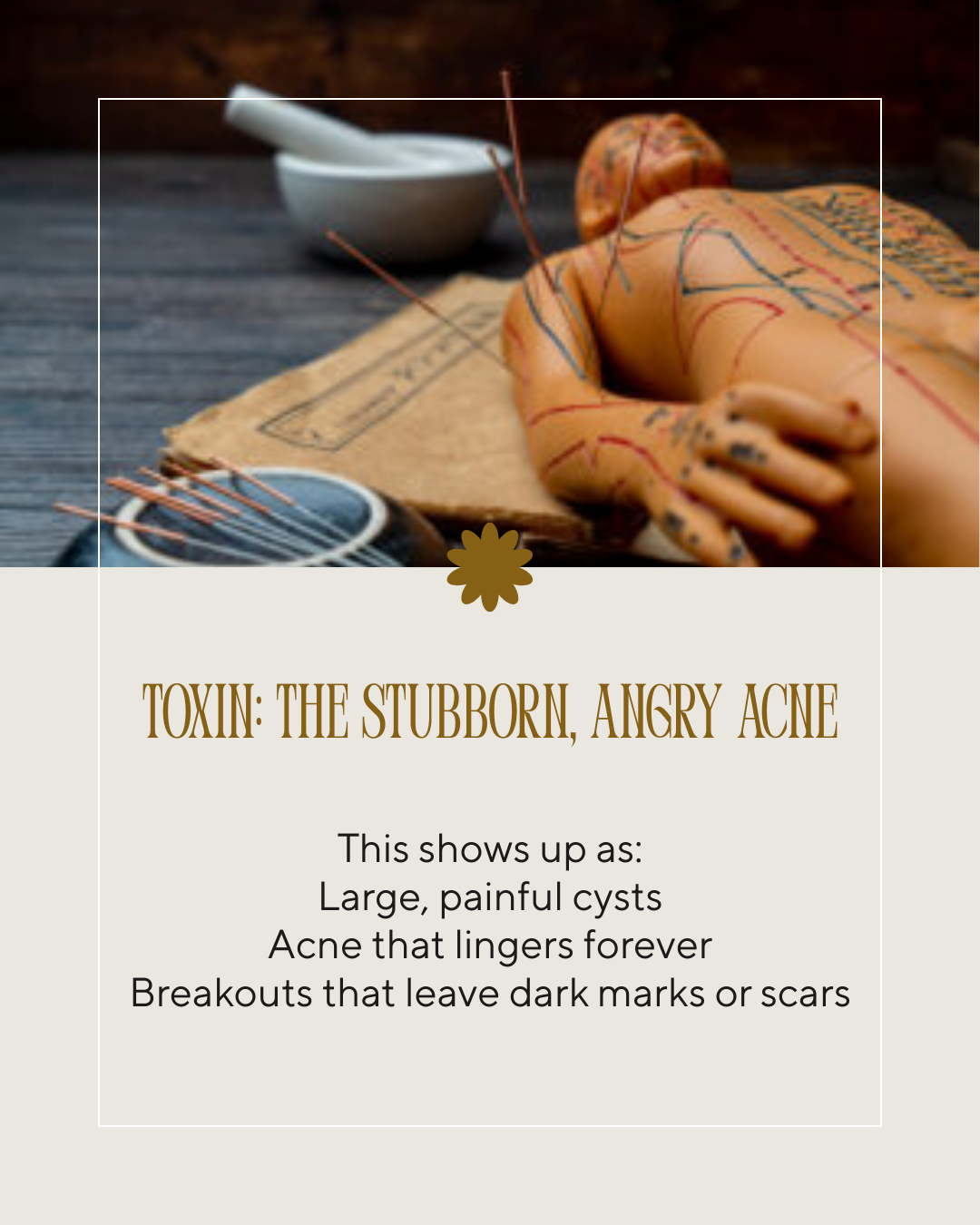 An image of acupuncture needles inserted into a plastic acupuncture model showing the meridian and points with the text "Toxin: The stubborn, angry, acne. This shows up as: Padge painful cysts, acne that lingers forever, breakouts that leave scars: