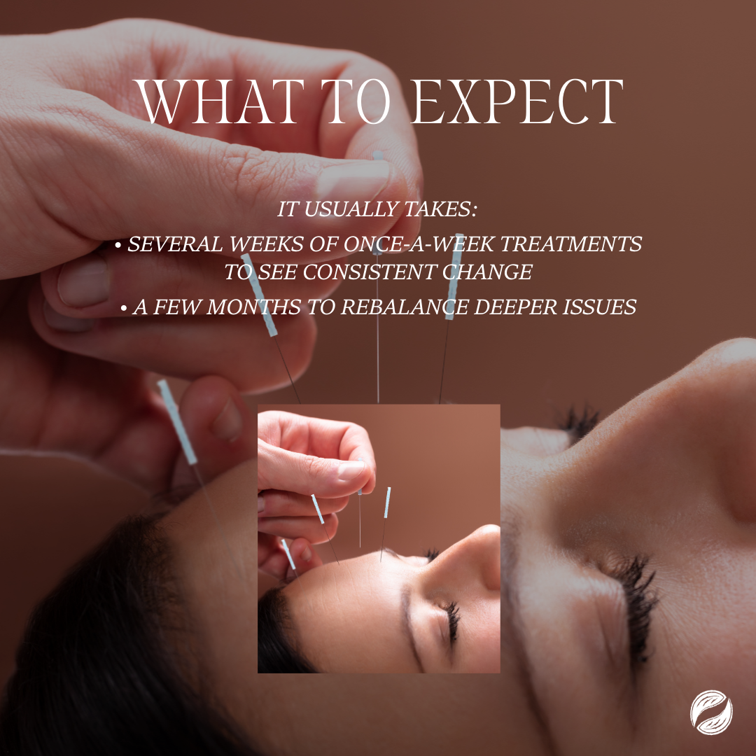 Close-up of a person's cheek receiving very fine cosmetic acupuncture needles for acne treatment, showing the calming, anti-inflammatory effect. With a summary of what to expect from the text to the right of the photo.