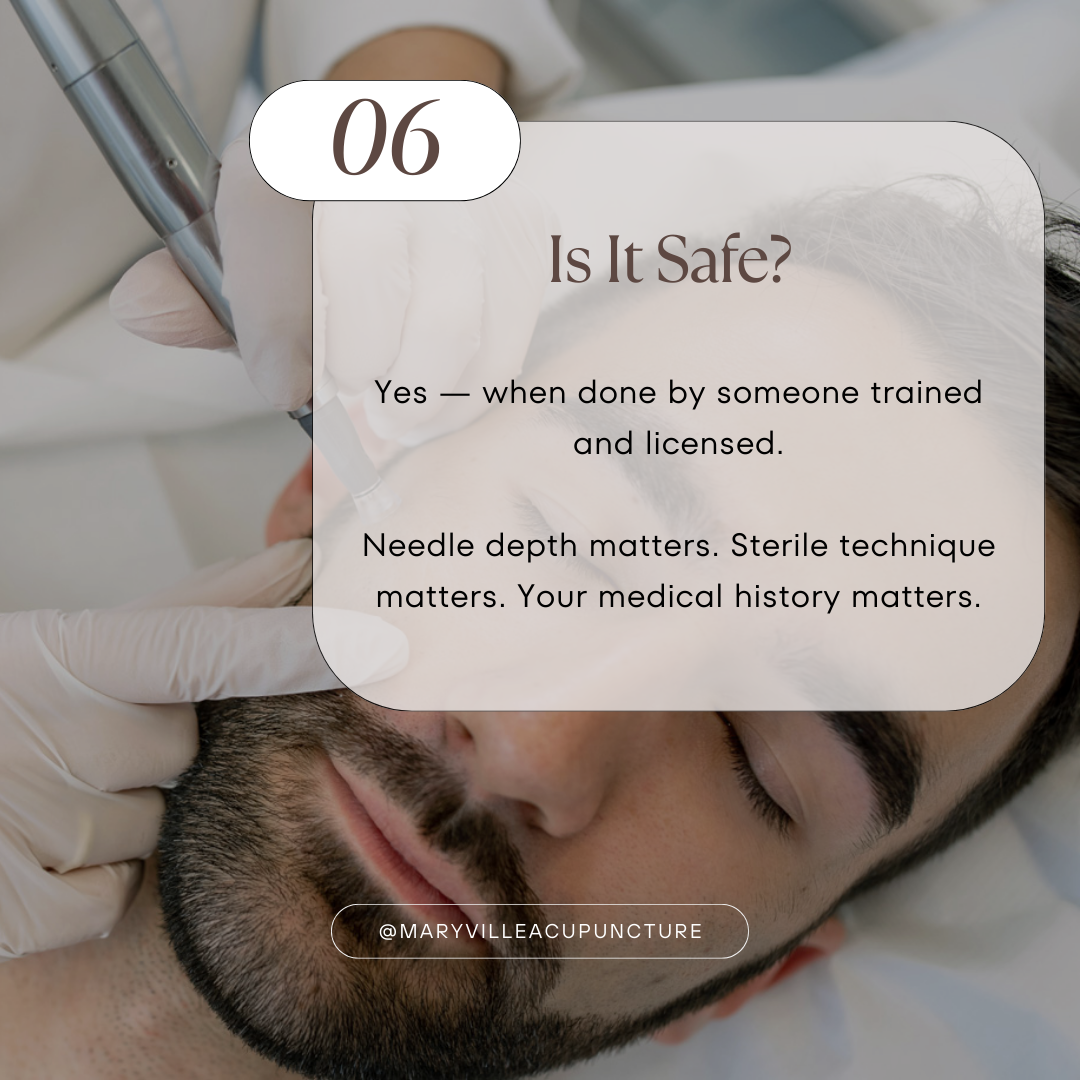 Upclose image of a man's face being treated with microneedling in a sanitary environment for acne scarring with text summarizing this section of the blog on the safety of microneedling