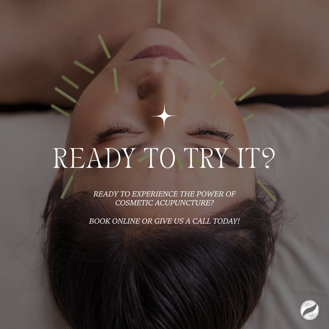 Close-up of a person's cheek receiving very fine cosmetic acupuncture needles for acne treatment, showing the calming, anti-inflammatory effect.