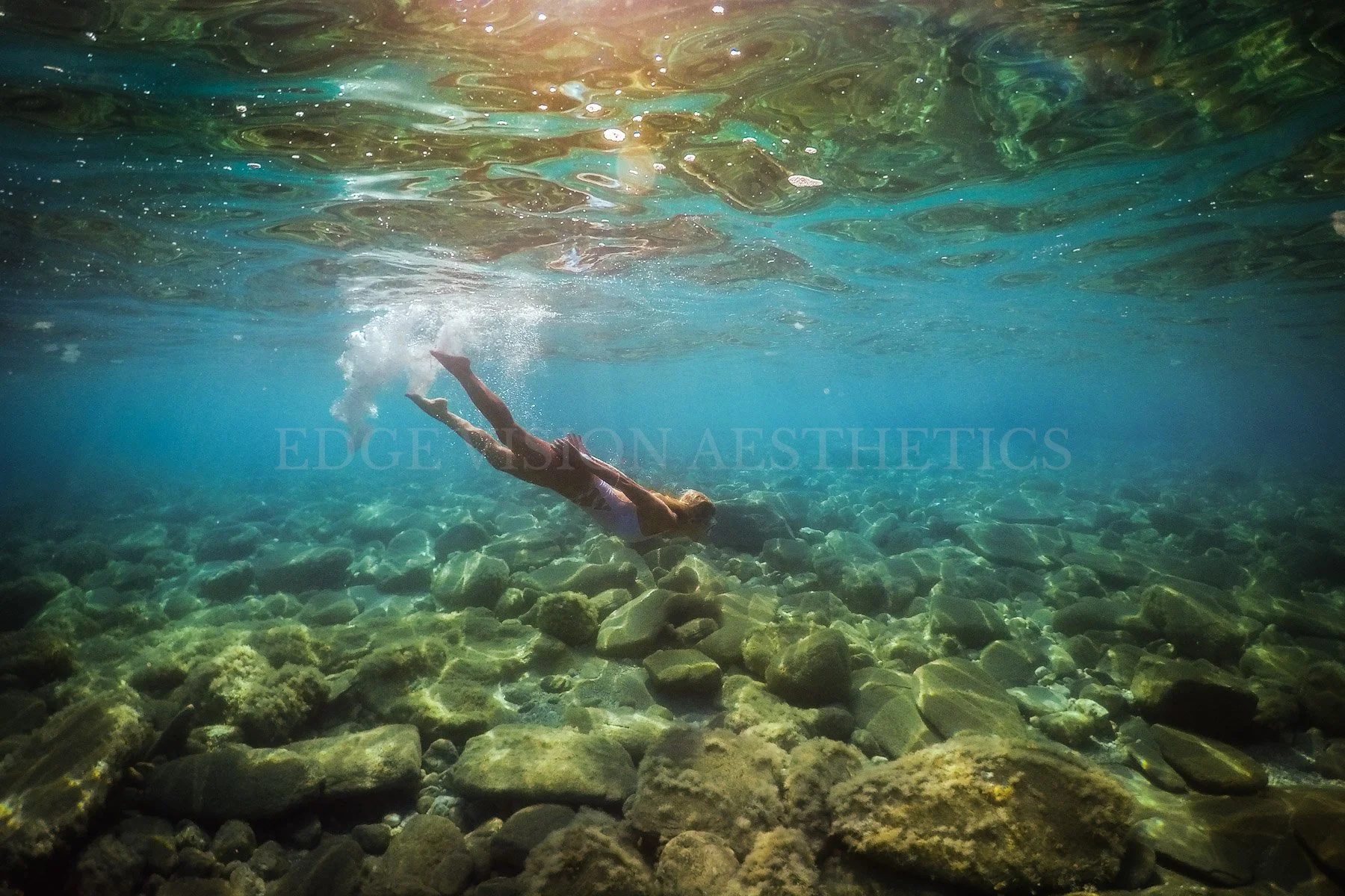 EDGE-VISION-AESTHETICS-0111092.jpg