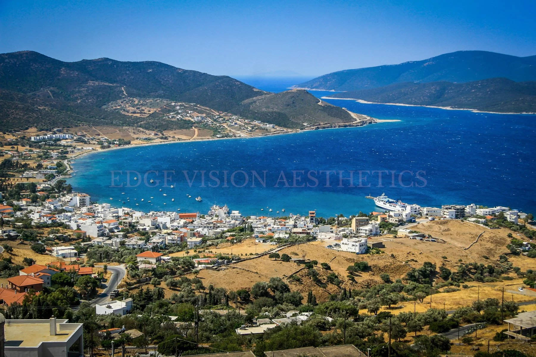EDGE-VISION-AESTHETICS-4634.jpg