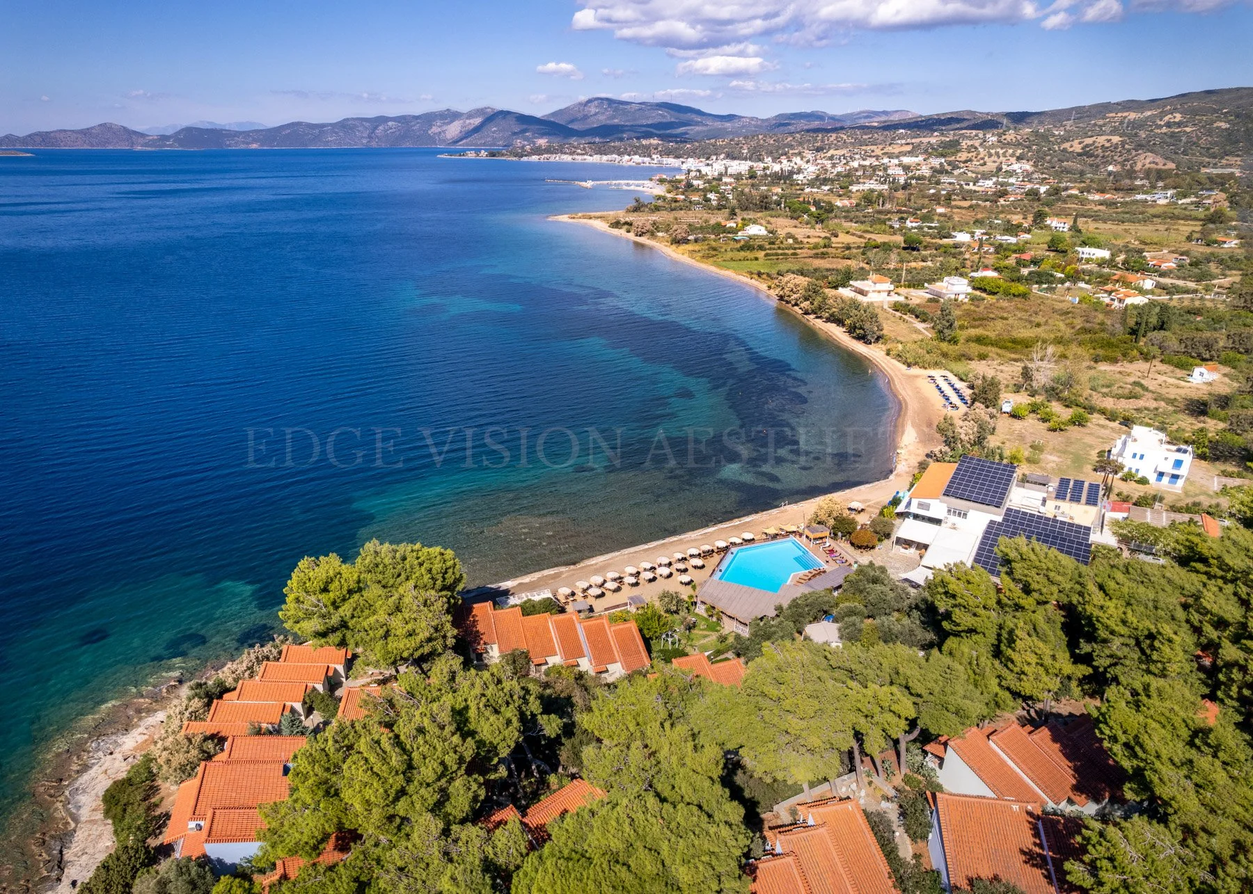 edge-vision-aesthetics-0408.jpg
