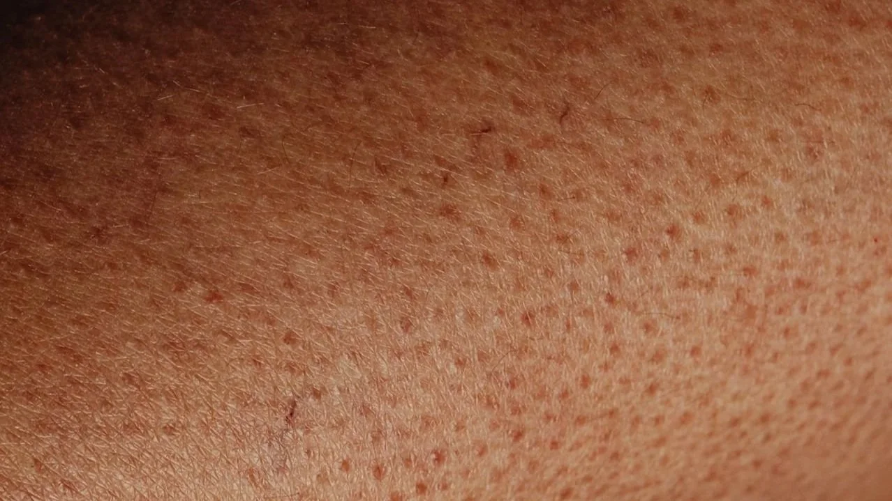 Close-up of dry skin with visible follicles