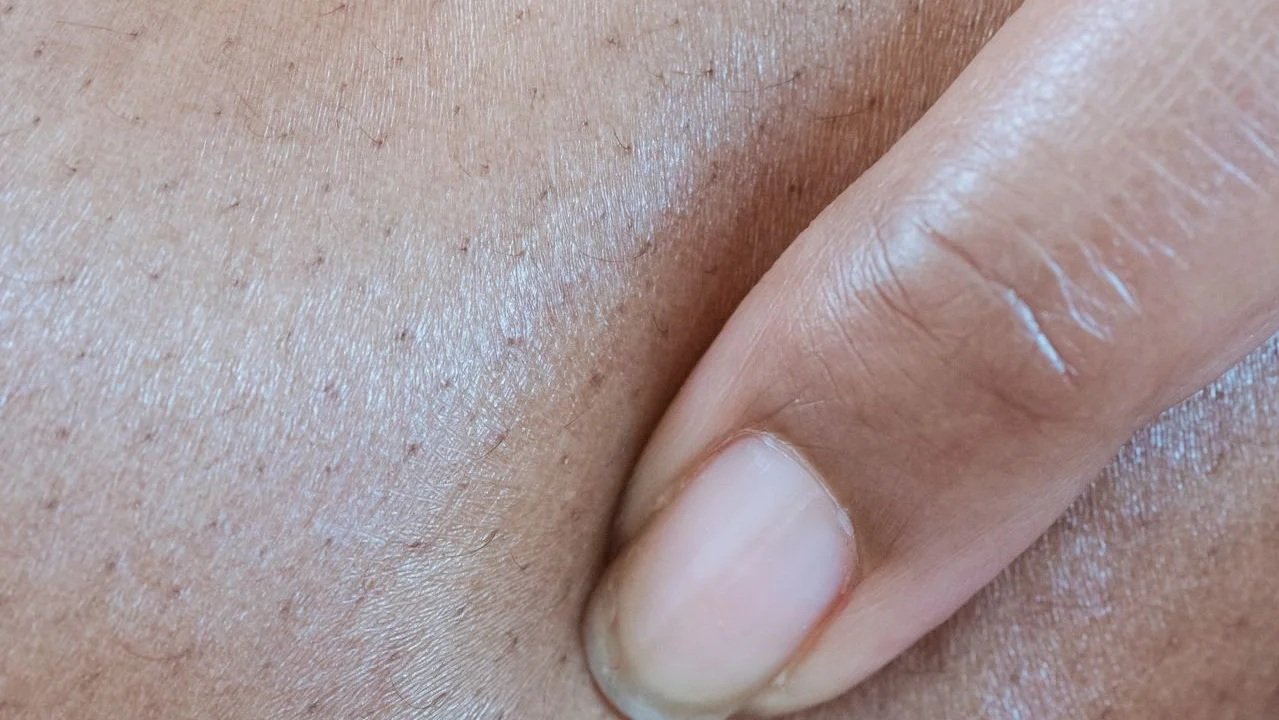 close-up of short hair growth on skin