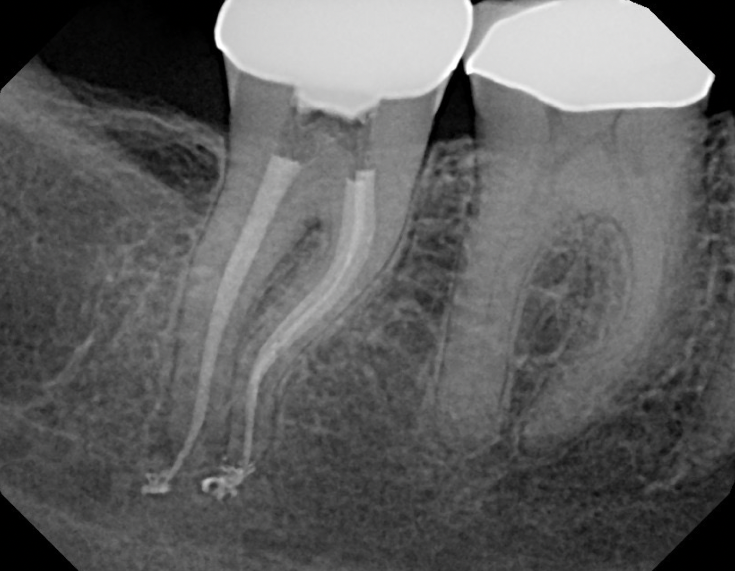 OBTR8-David-Landwehr-dental-xray-2.png