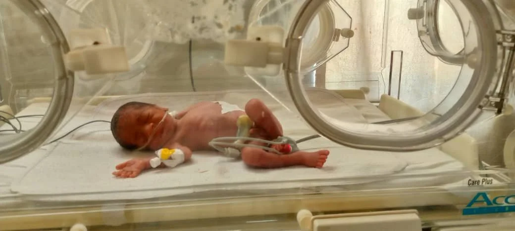 Survival of a 700 g Baby at Nundu Deaconess Hospital