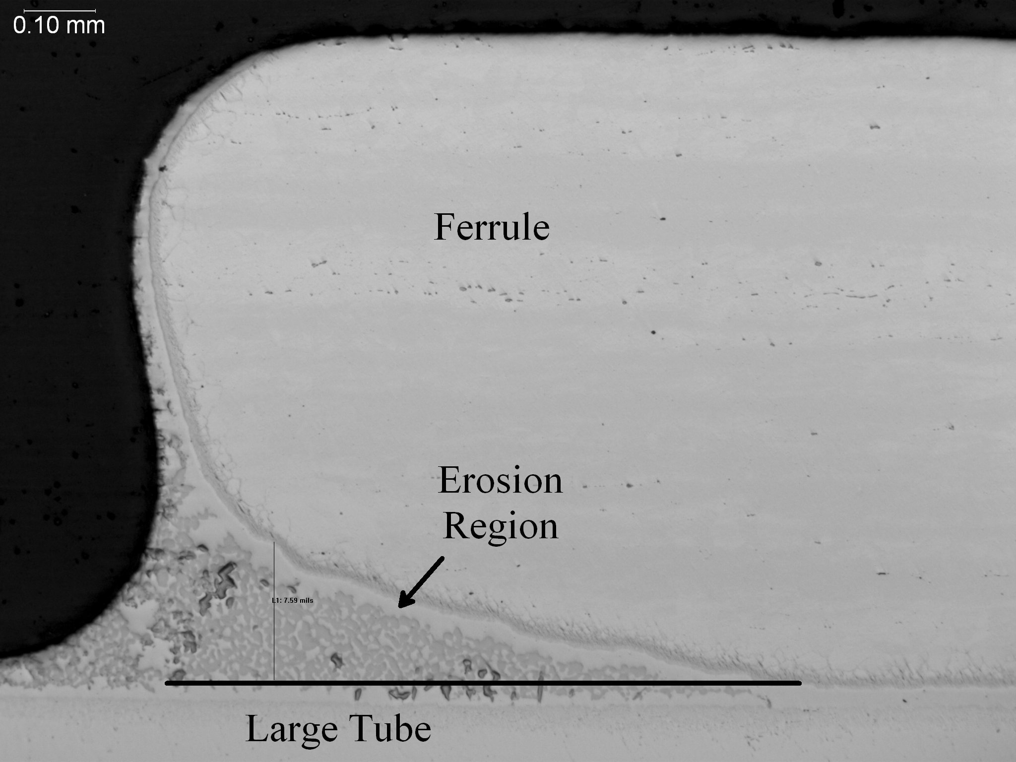 Base metal erosion in braze joint, metallographic cross-sectional evaluation identifying an erosion region and parent metal dissolution at the ferrule and tube interface per AWS C3.8M and ASTM E3 under ISO 17025 accredited laboratory standards.
