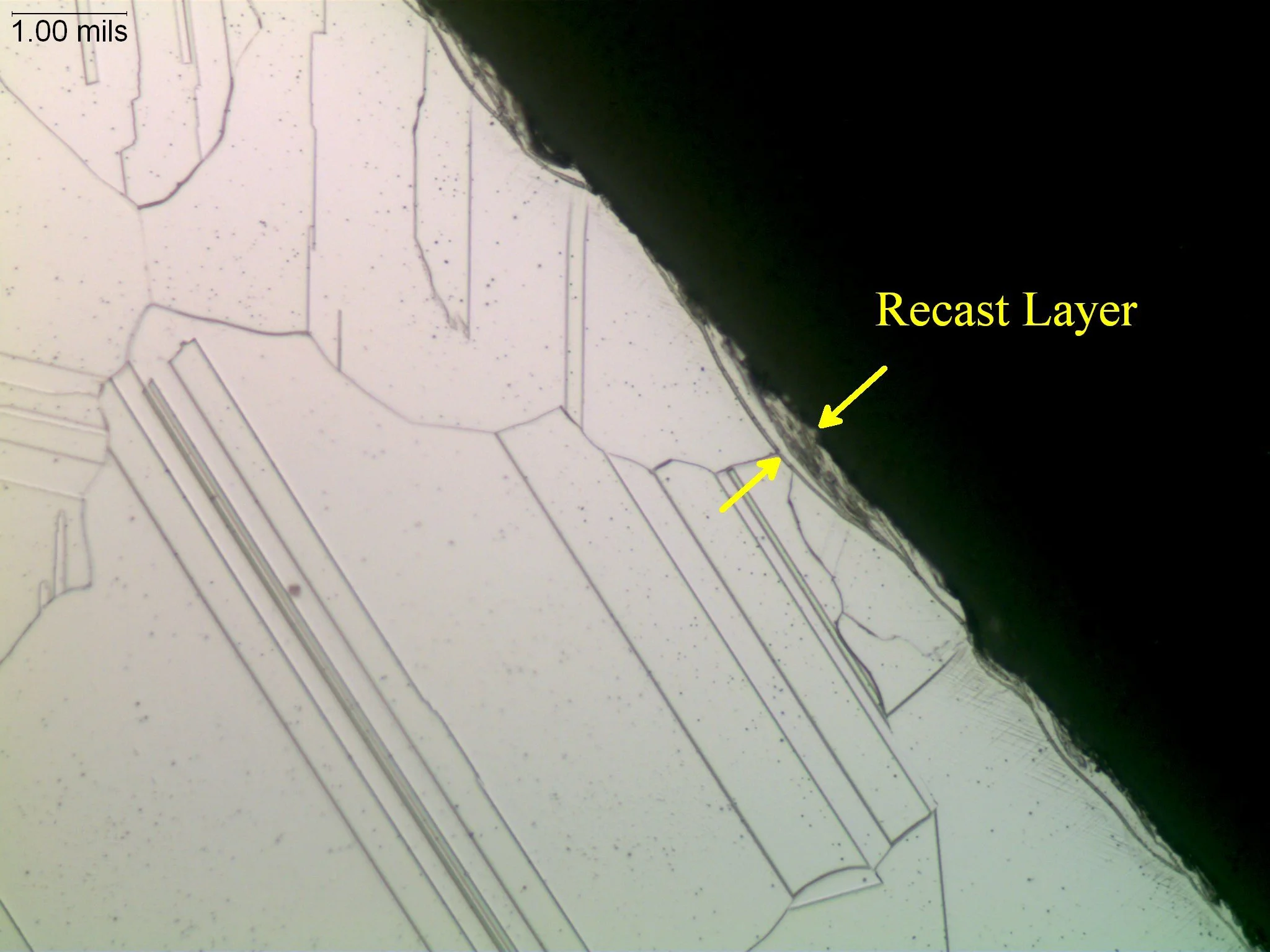 Electrical discharge machining (EDM) recast layer on a superalloy matrix, metallographic cross-sectional evaluation identifying an electrical discharge machining recast layer white layer profile, localized thermal alteration zone thickness, and an et
