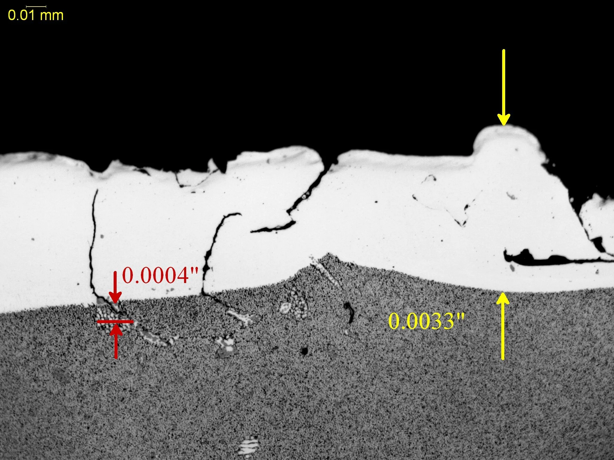 Electrical discharge machining (EDM) thermal alteration zone with sub-surface cracking, metallographic cross-sectional evaluation measuring an EDM recast layer white layer thickness, localized spalling micro-cracks, and deep microstructural fracture 