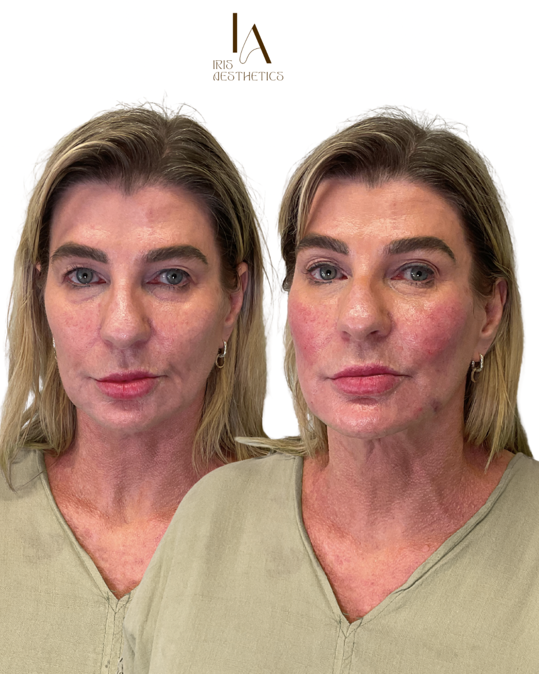 Untitled design 2.PNG