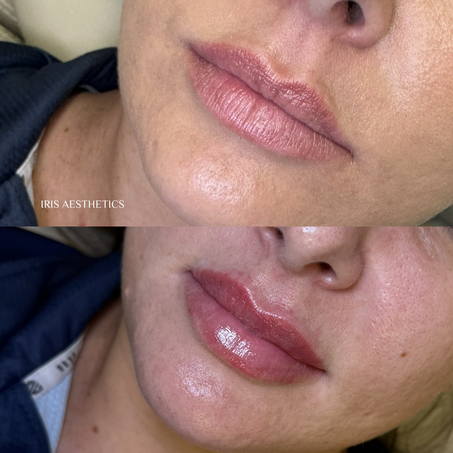 Close-up images of lips before and after lip gloss application, showing fuller, shinier lips in the second image.