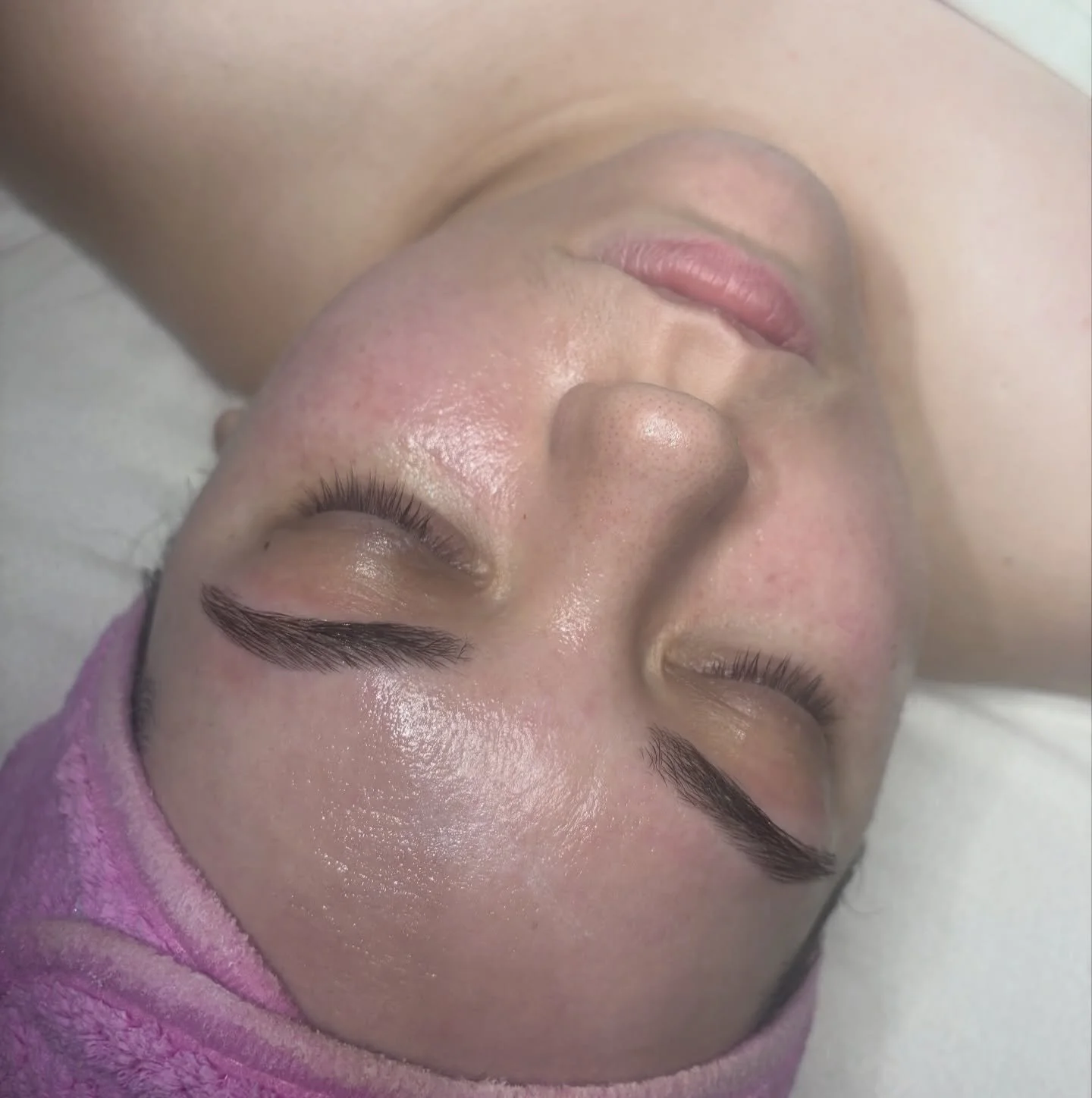 After 👉🏽 Before - Brow Wax &amp; Facial 🍯🫧 

&bull;&bull;&bull;

#esthetician #browwaxing #facialbeforeandafter #estischool