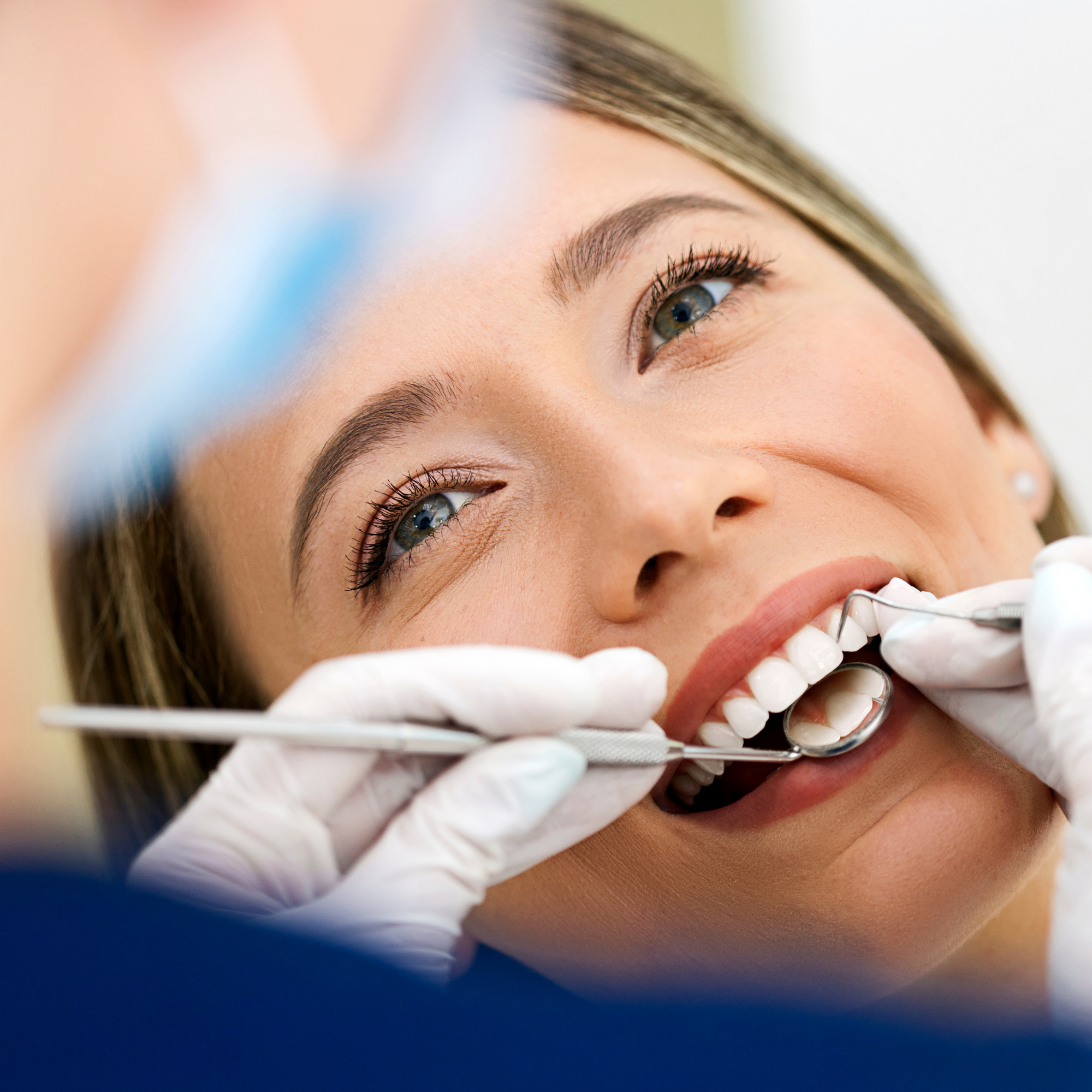 All About Crowns: What They Are and Why You Might Need One