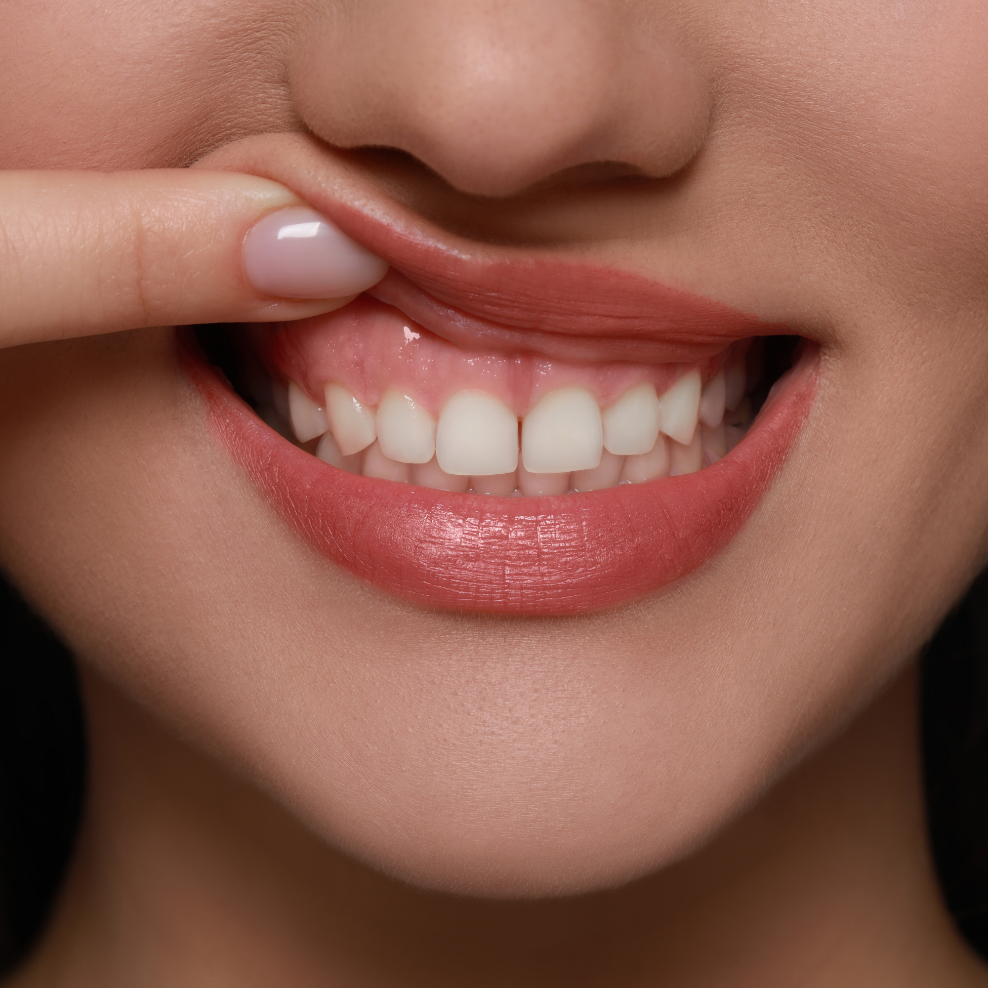 What Your Gums Are Trying to Tell You