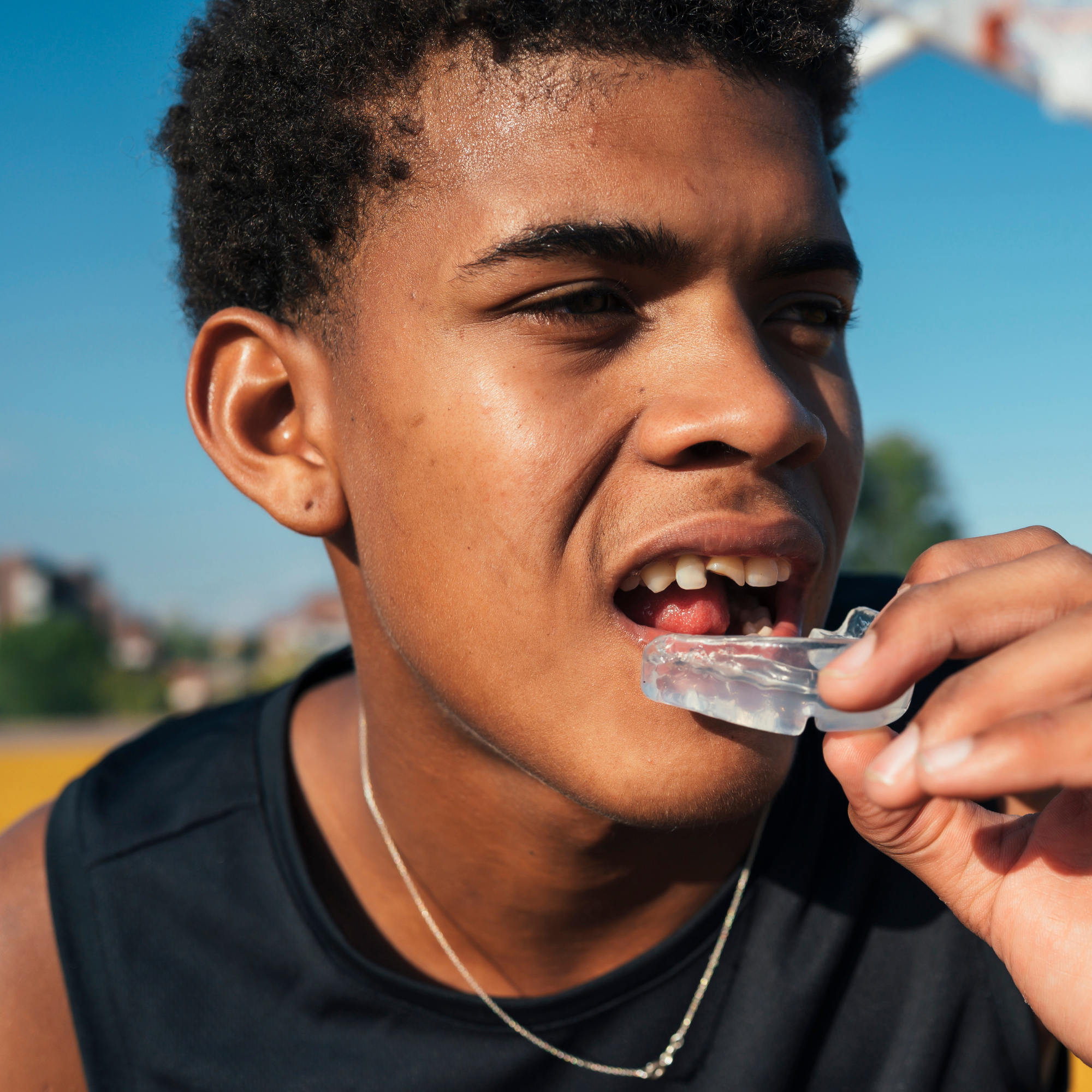 Protecting Your Child’s Smile During Sports