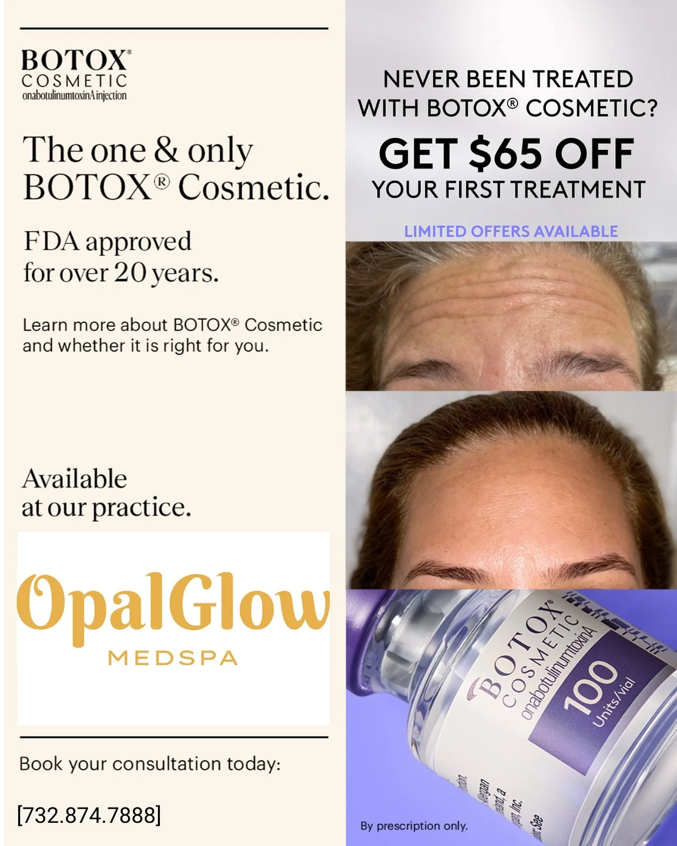 ✨ First-Time Botox Special ✨
Thinking about trying Botox? Now&rsquo;s the perfect time! Enjoy $65 off your first treatment and discover the subtle, refreshed look you&rsquo;ve been waiting for 💎

📅 Book your appointment today and start your glow jo