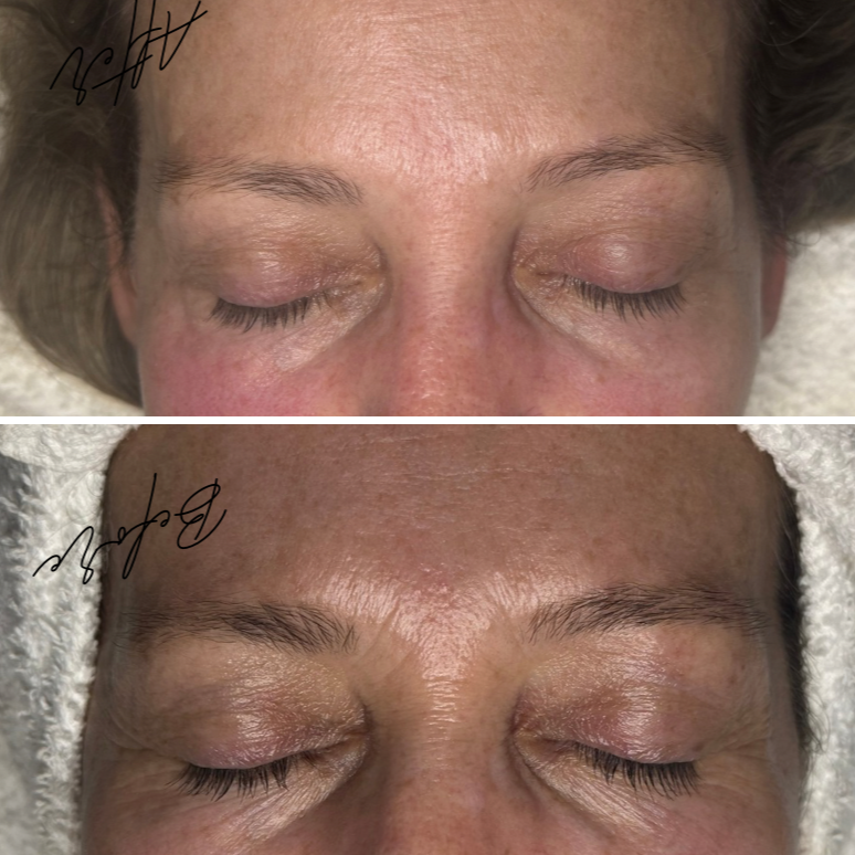 BIO REPEEL + PROCELL