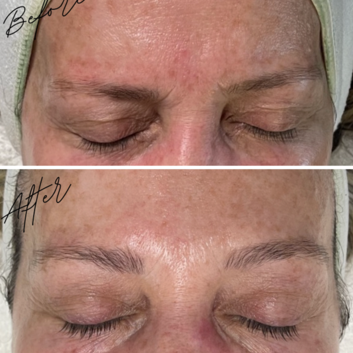 TWO OXYGEN  FACIALS AND HOME CARE