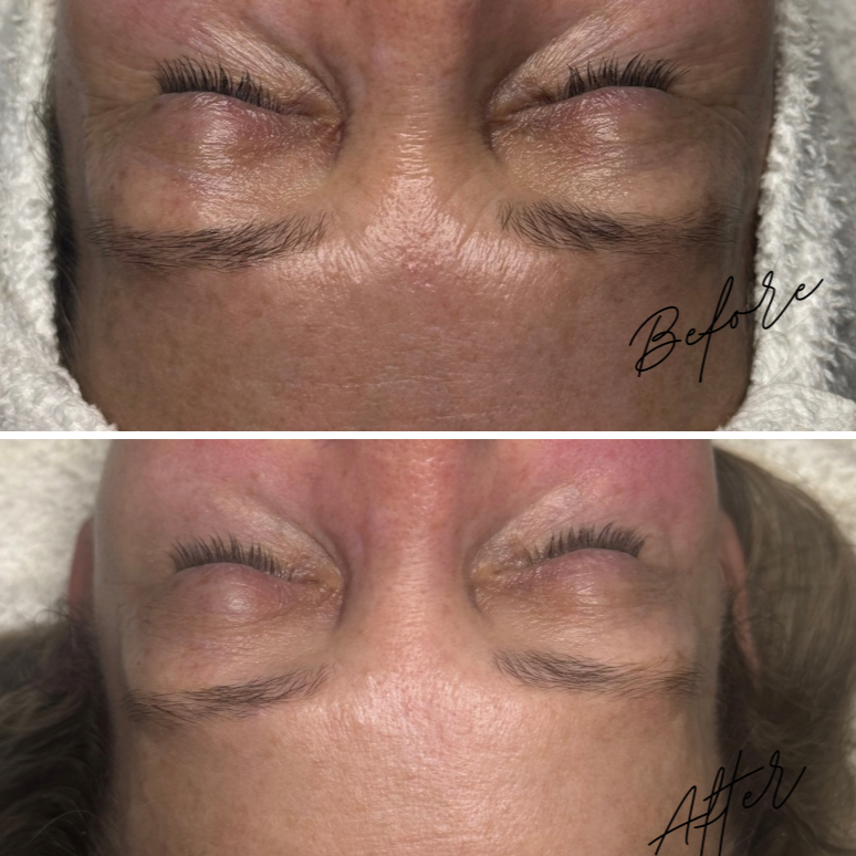 BIO REPEEL + PROCELL