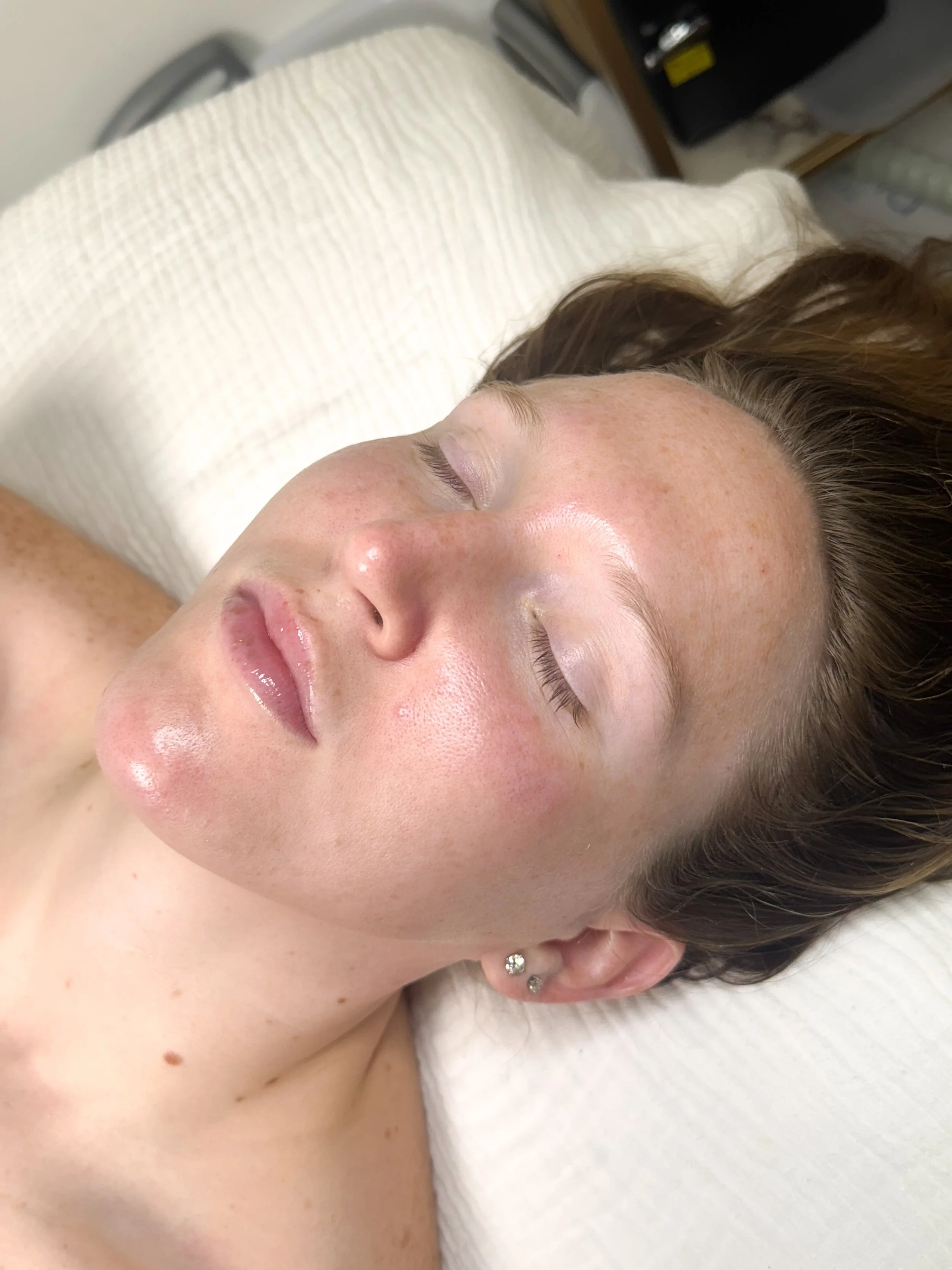 OXYGEN FACIAL