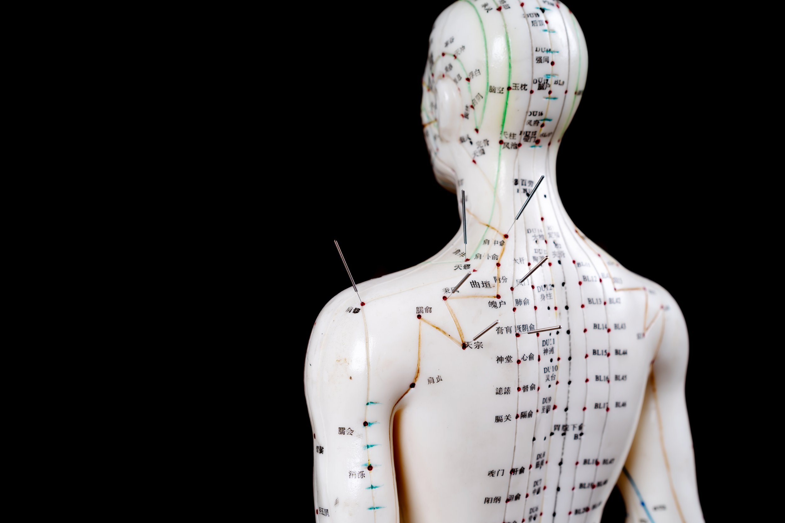 Acupuncture model showing meridian lines and acupuncture points