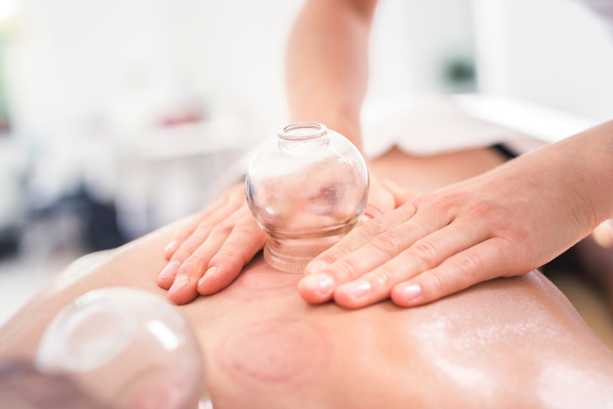Cupping therapy on a person's back with glass cups.