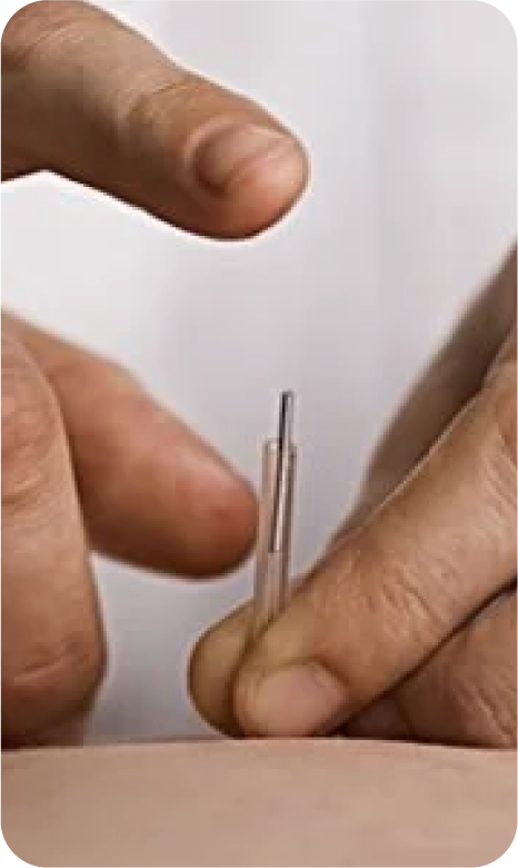 Close-up of hands using a small tool or needle, possibly for medical or craft purposes.