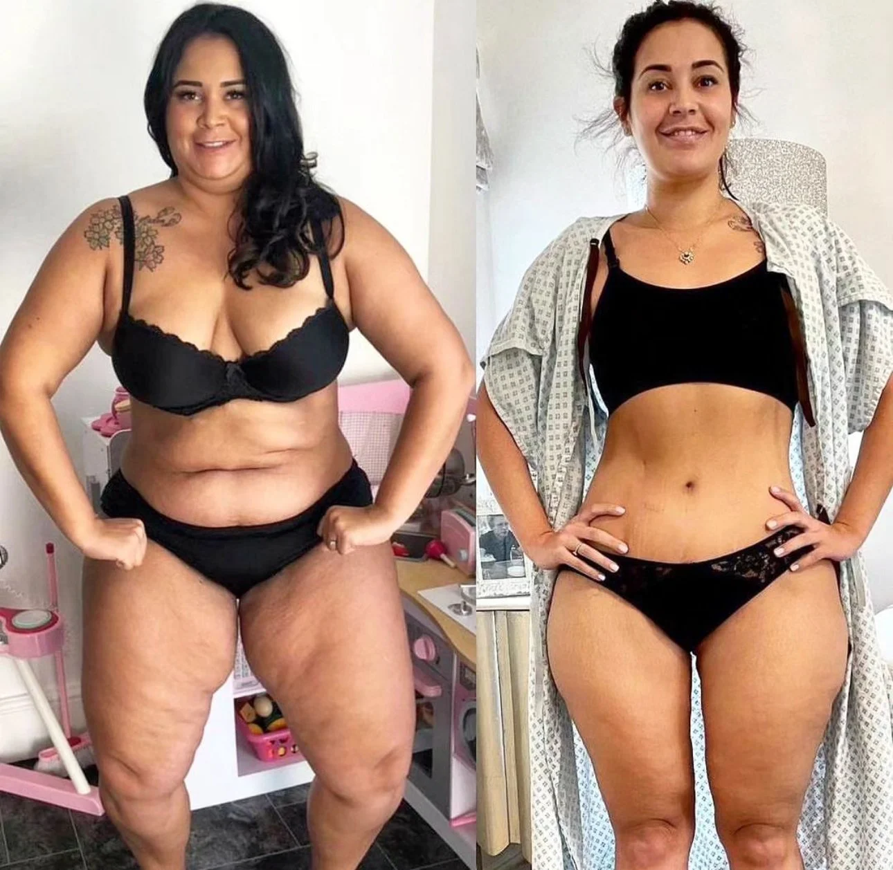 Side-by-side comparison photos of the same woman before and after weight loss, wearing black underwear, with her hands on her hips, in a bathroom.