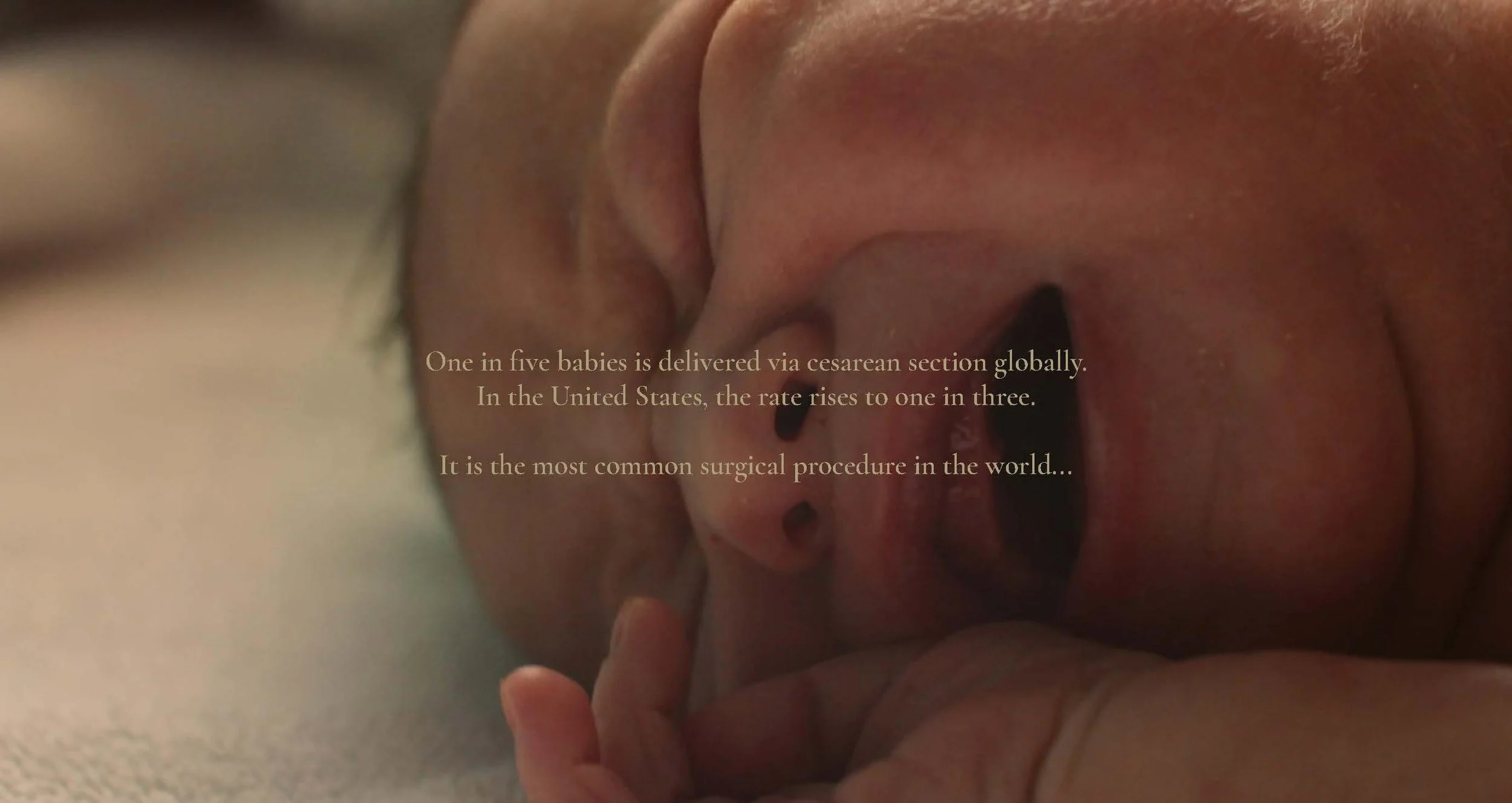 Cesarian Pitch Deck_v2 copy_Page_03.jpg