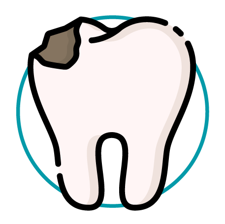 Broken, chipped, or cracked teeth