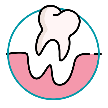Knocked-out tooth/teeth