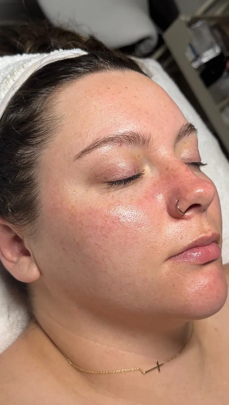 🍂 Reset Your Skin for Fall 🍂
Say goodbye to summer buildup and hello to fresh, glowing skin with a Hydrofacial! This treatment deeply cleanses, replenishes, and revives your skin after months of sun, sweat, and environmental stress.
✨ Benefits of