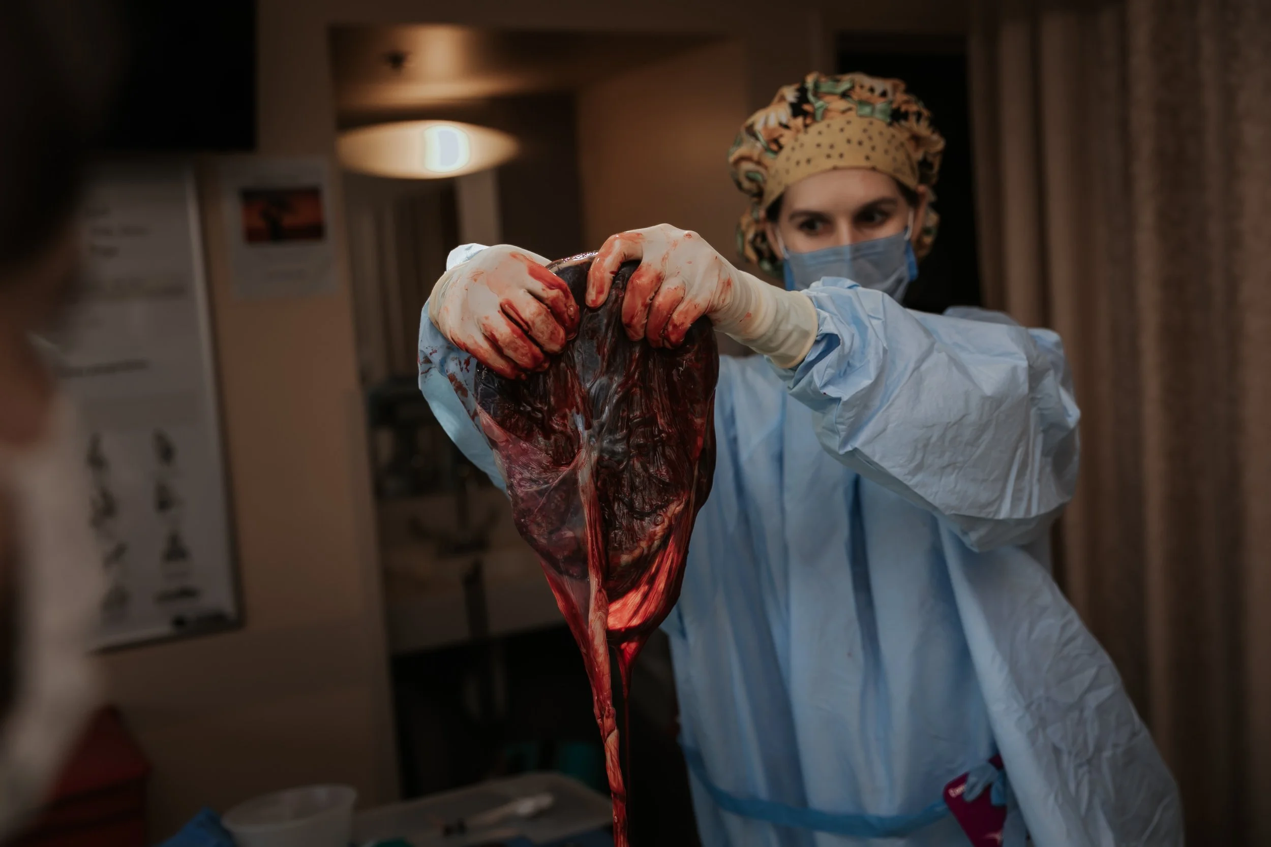 Photo of El Camino Los Gatos midwife holding up placenta.