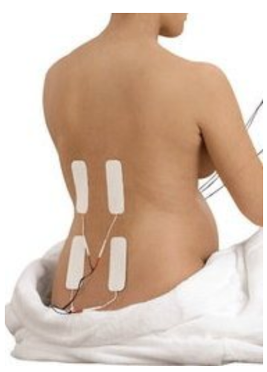 Obstetric TENS Hire