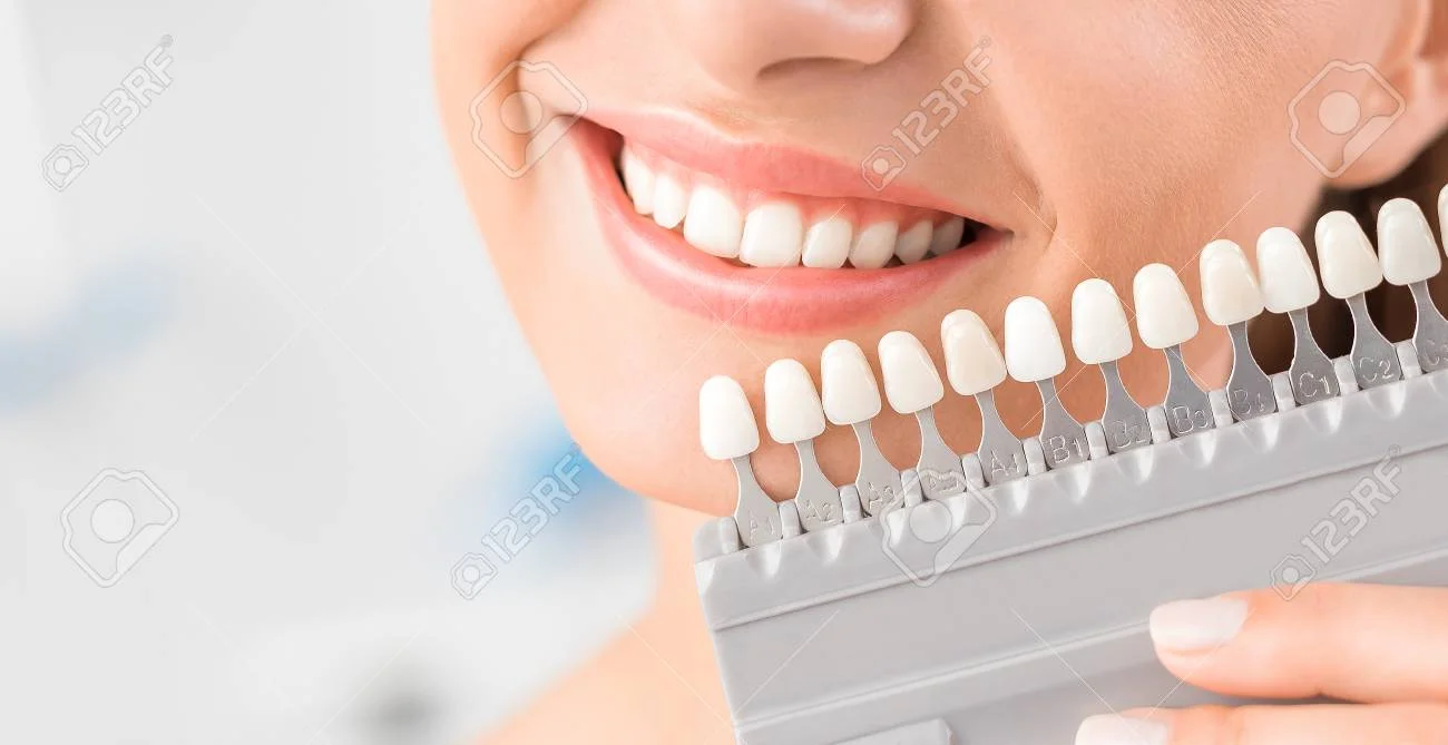 89631340-beautiful-smile-and-white-teeth-of-a-young-woman-matching-the-shades-of-the-implants-or-the-process-.jpg