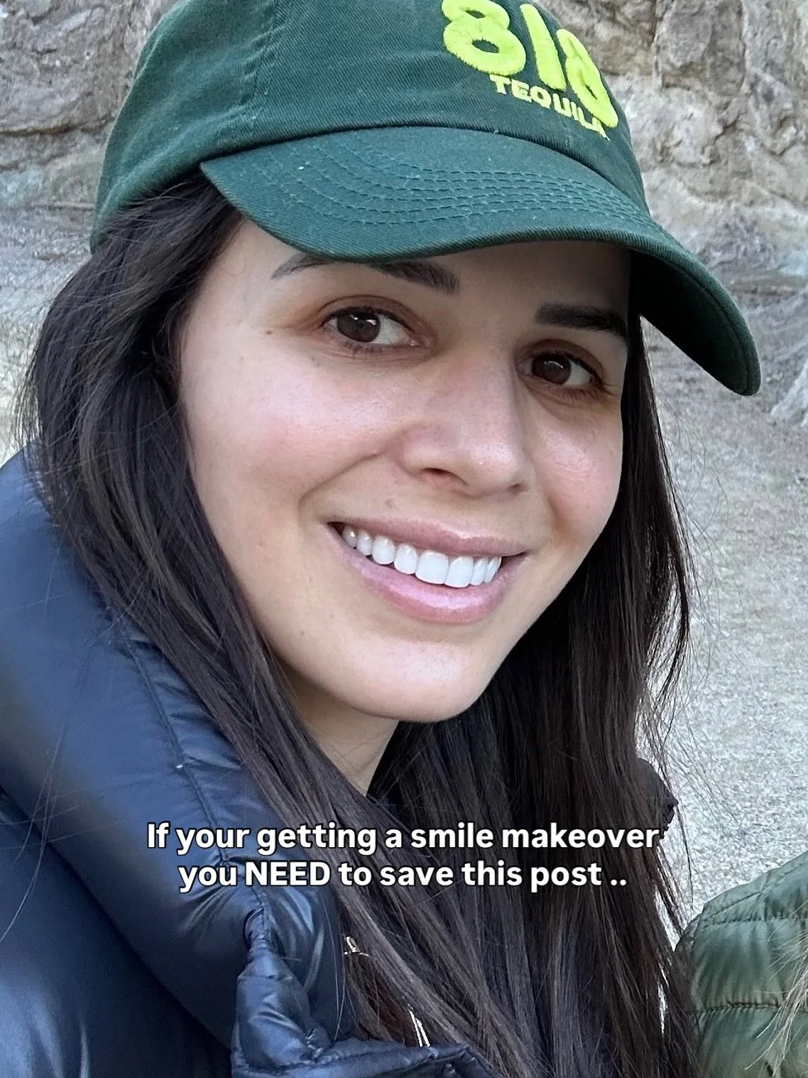 TOP TIP 👇🦷

Come to your consultation with your &lsquo;wants&rsquo; and &lsquo;don&rsquo;t want&rsquo; with imagery &amp; videos just saved in your notes 🗒️

This will help us understand the vision of what you are wanting for your new smile! 

We 