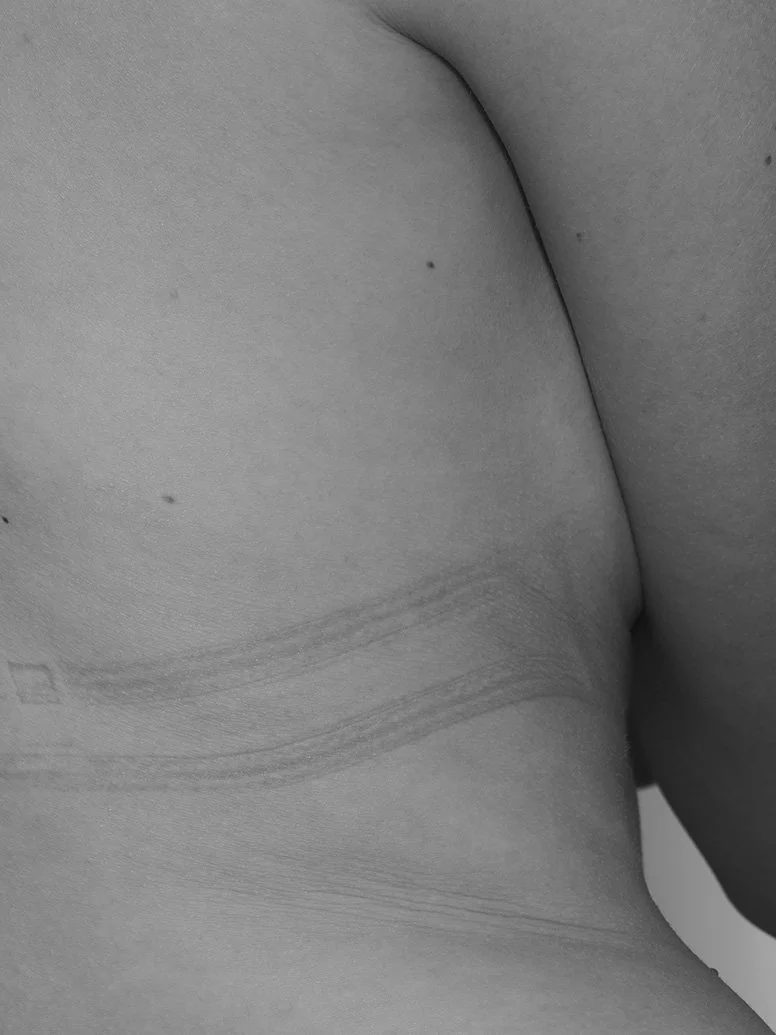 skin body strapmarks arved21.jpg