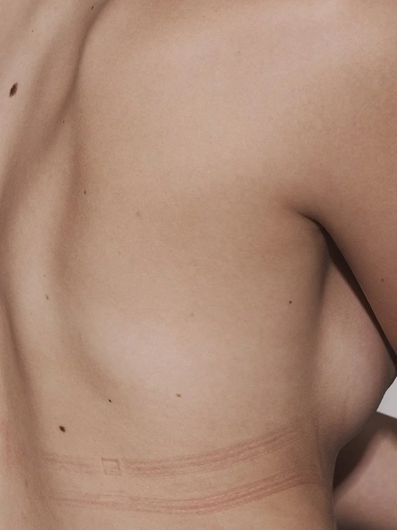 skin body strapmarks arved22.jpg