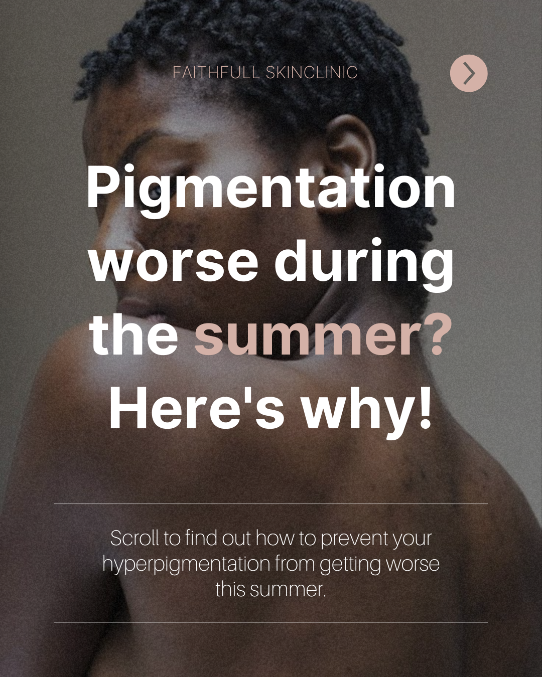 Close-up of a woman with short natural hair. Overlaid text about pigmentation worsening during summer and how to prevent it.