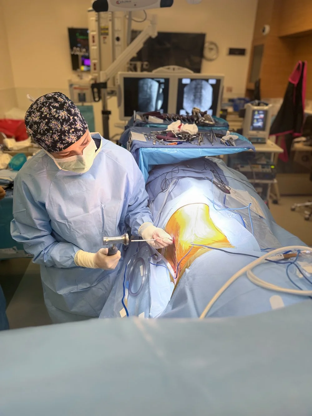 Surgeon performing surgery in an operating room with medical equipment and monitors visible.