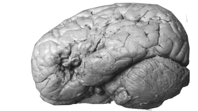 Paul Broca and Modularity of Mind